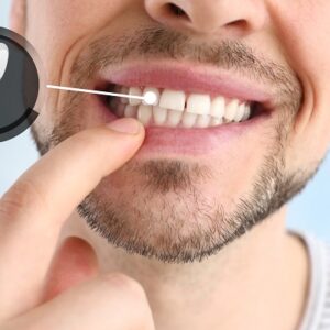 6 Compelling Reasons Why Dental Implants Could Be Your Best Choice