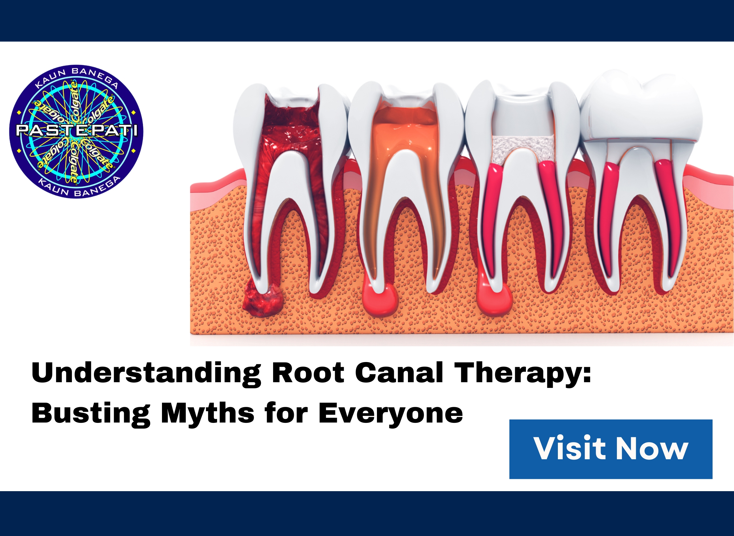 Understanding Root Canal Therapy: Busting Myths for Everyone
