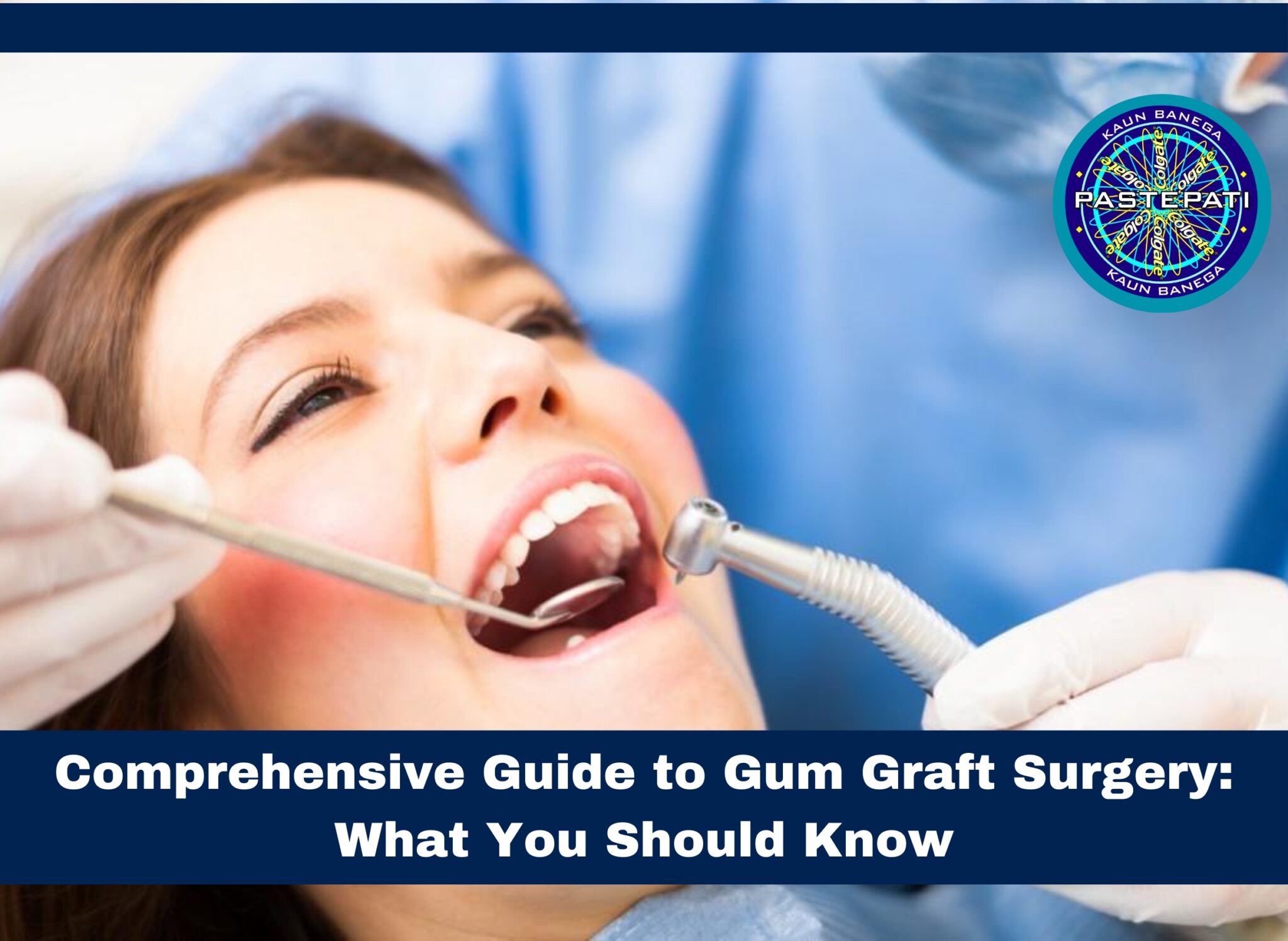 Comprehensive Guide to Gum Graft Surgery What You Should Know