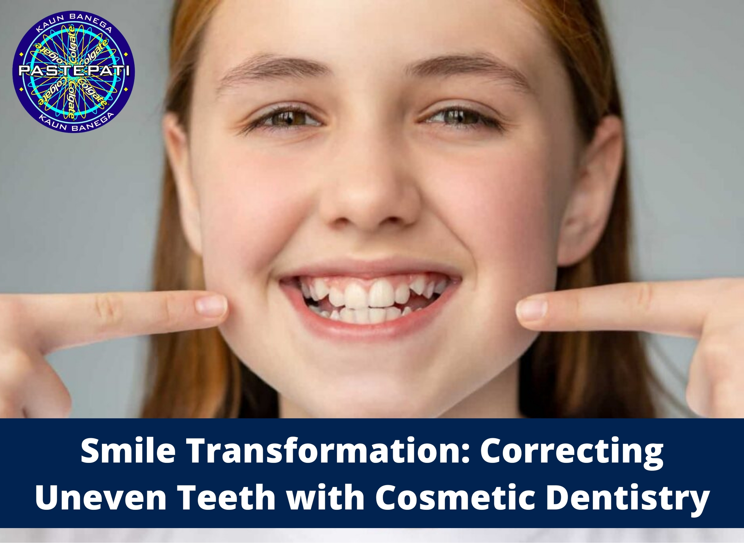 Smile Transformation: Correcting Uneven Teeth with Cosmetic Dentistry